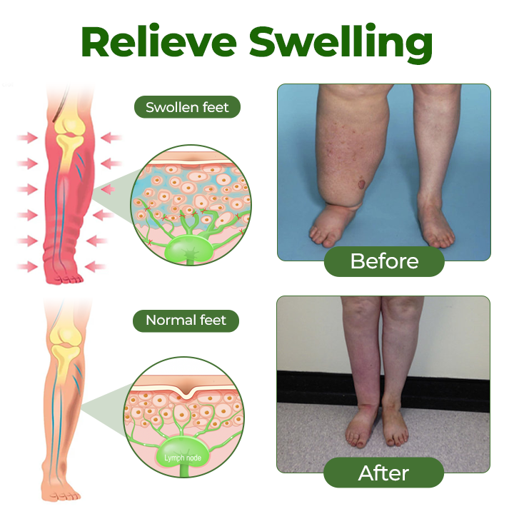 Timilk®Professional Leg Circulation Cream