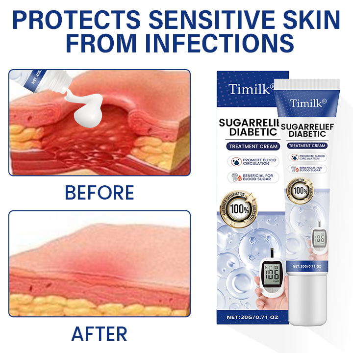 Timilk® SugarRelief Diabetic Treatment Cream