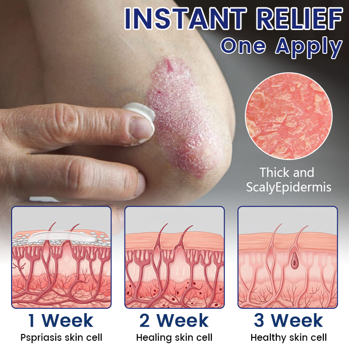 Timilk® DermaSooth Repair Cream