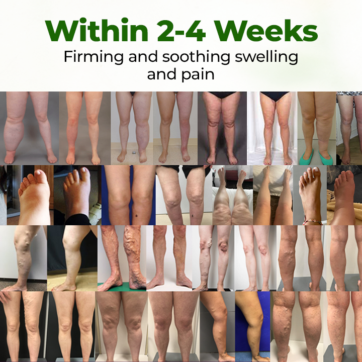 Timilk®Professional Leg Circulation Cream