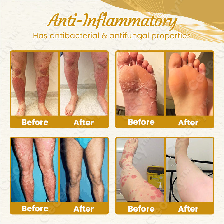 Ceoerty™ DetoxiSlim Foot Bath Beads-A