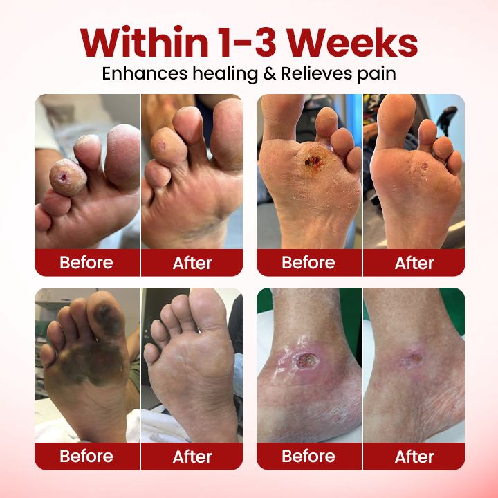 Timilk® VitaGluco Diabetic Care Cream