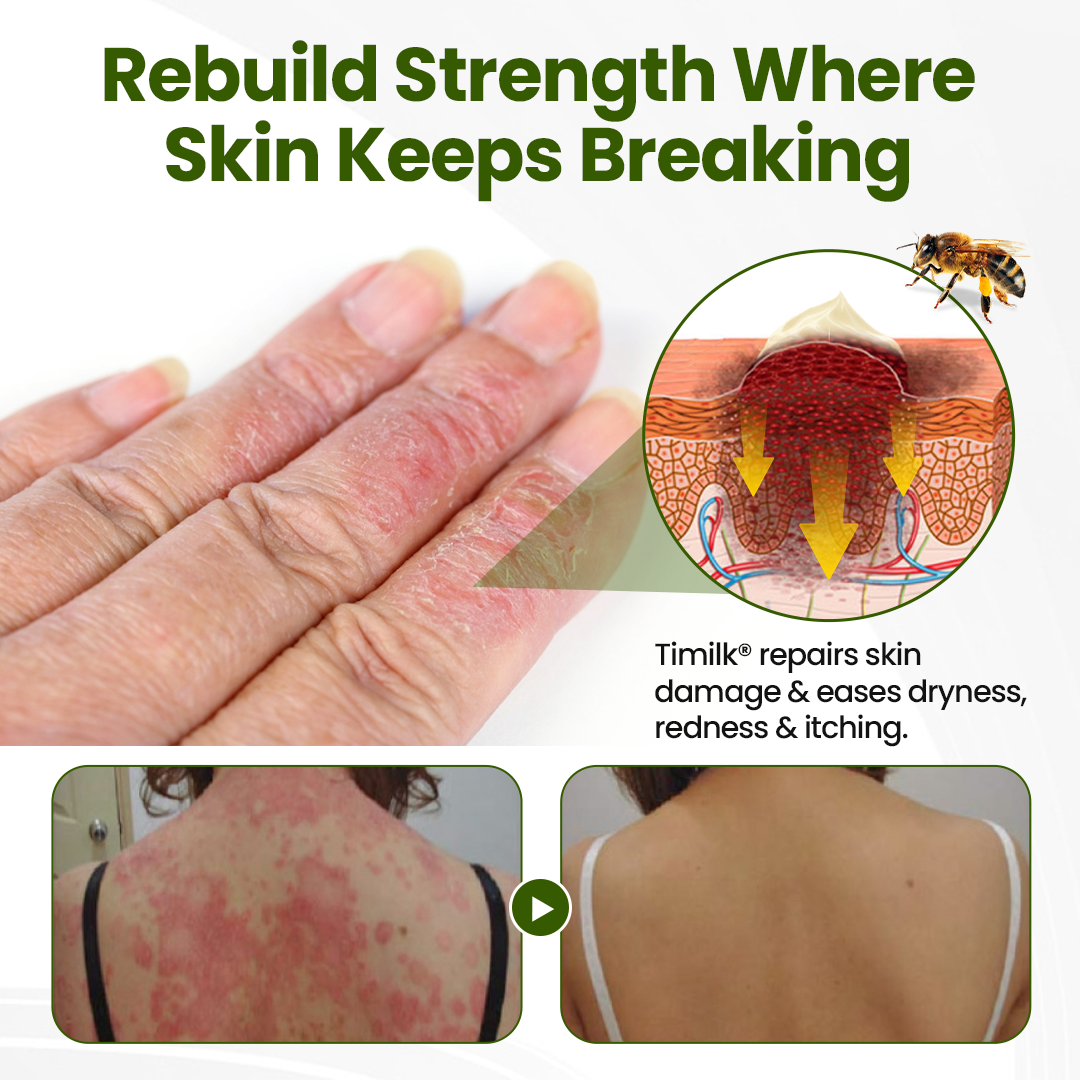 Timilk® BeePeptide RootSoft DualRelief Cream