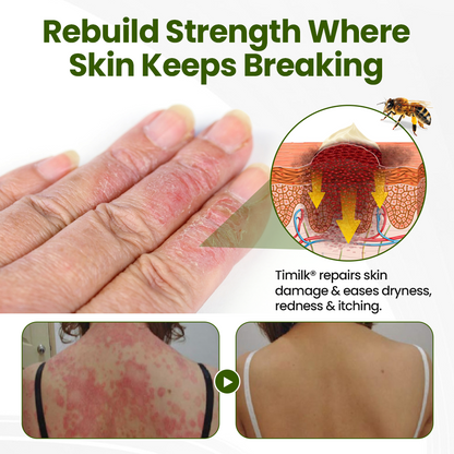 Timilk® BeePeptide RootSoft DualRelief Cream