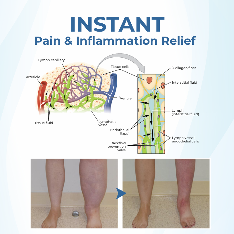 Timilk® TheraVein Varicose Herbal Spray