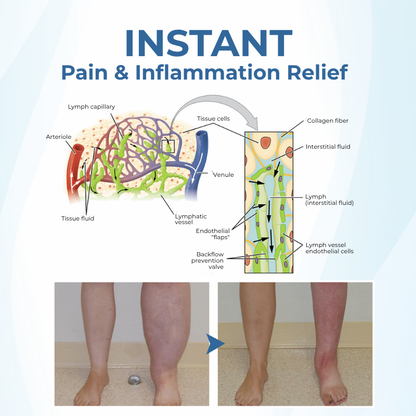 Timilk® TheraVein Varicose Herbal Spray