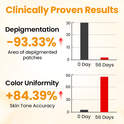Timilk® VitiGone Rapid Spray — 2–3 Week Repigmentation with OTDS