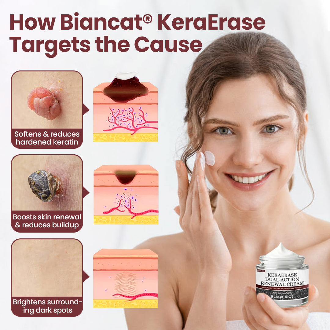 Biancat®KeraErase Dual-Action Renewal Cream ✨