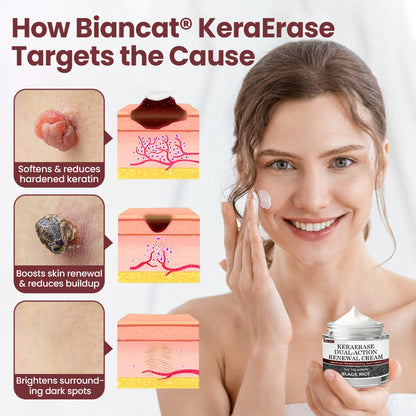 Biancat®KeraErase Dual-Action Renewal Cream ✨