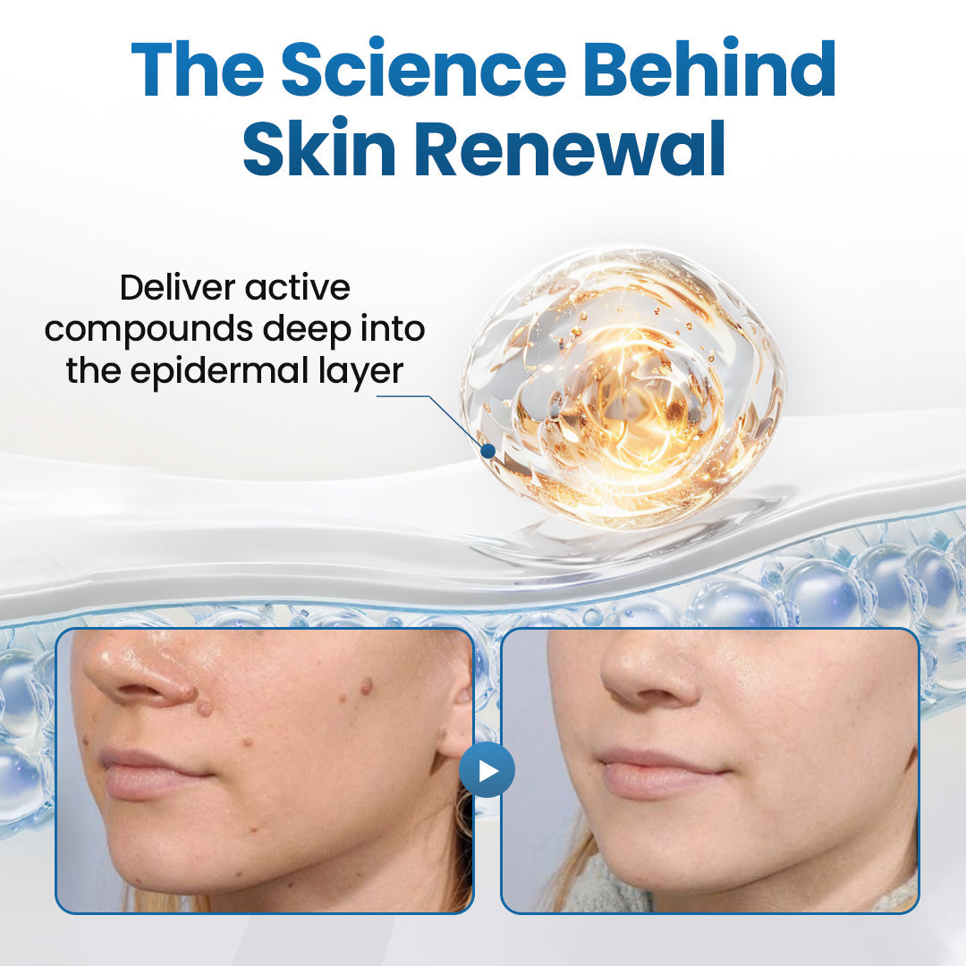 Biancat® BumpFlatten Cream (A)