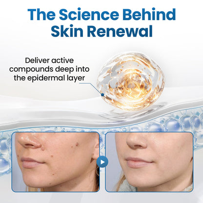 Biancat® BumpFlatten Cream (A)