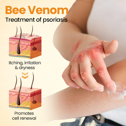 Timilk® BeeLieve Psoriasis Skin Care