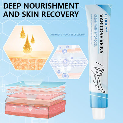 Ceoerty™ Varicose Veins Cream with Hydrogel（A)