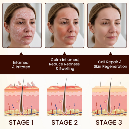 Timilk® Bee Venom Multi-Repair Cream (A)