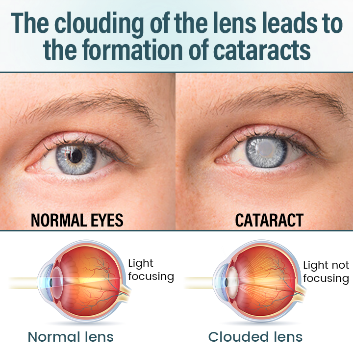 Timilk® OptiFusion Nano Eye Drops Serum (A)