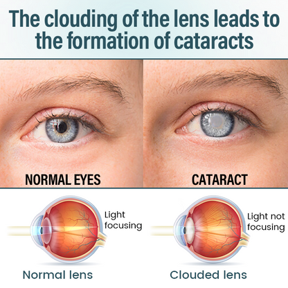 Timilk® OptiFusion Nano Eye Drops Serum (A)