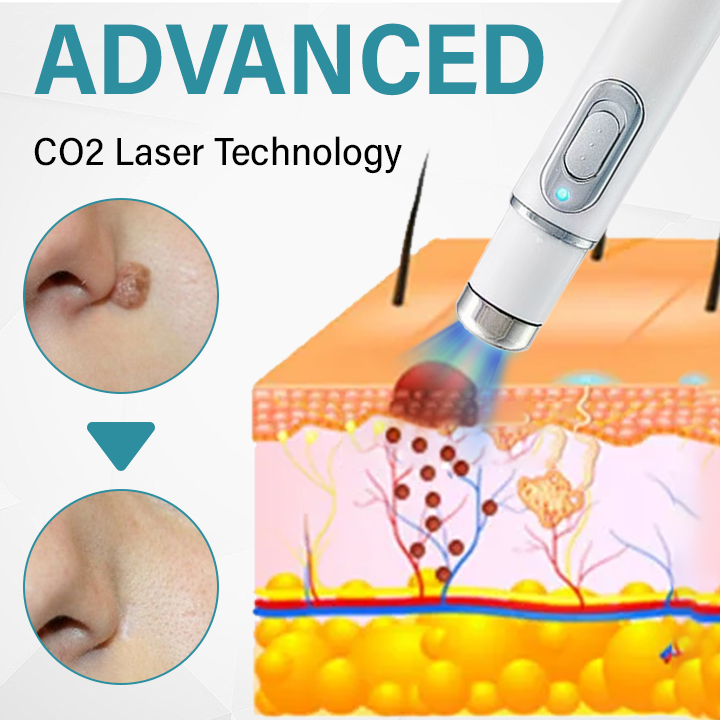 Bikenda® SpotAway Painless Laser Mole Removal Pen