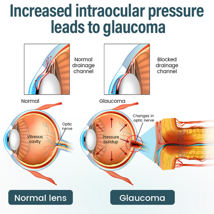 Timilk® OptiFusion Nano Eye Drops Serum (A)