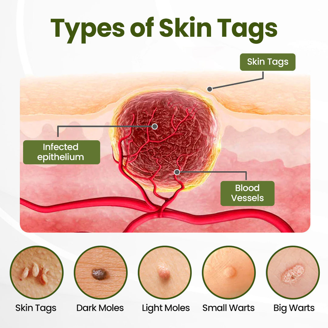 Biancat® MagneErase Renewal Cream