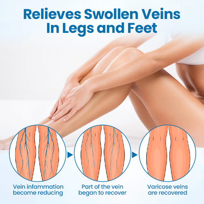 Timilk® VeinGuard Herbal Spray-(A)