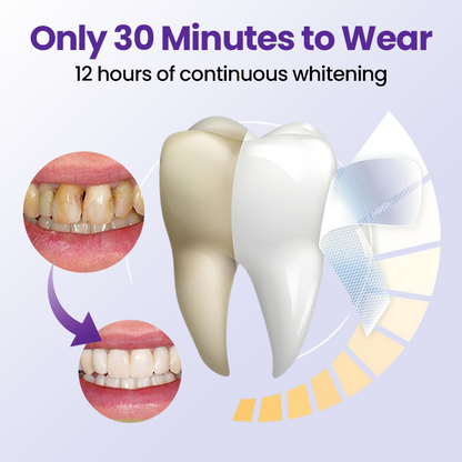 Biancat® 5D Teeth Whitening Strips (A)