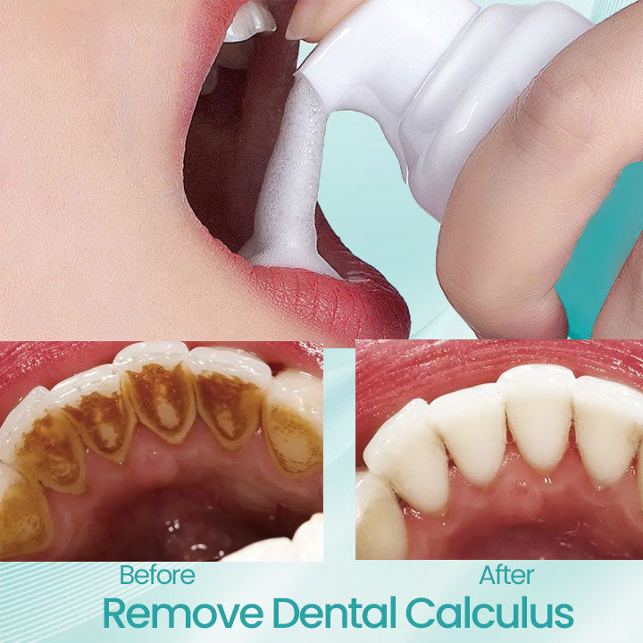 Ceoerty® RadiantSmile Oral Rinse (A)