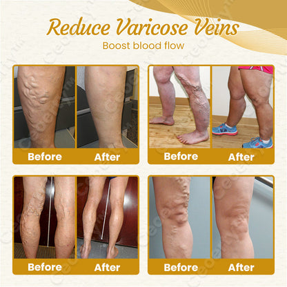 Ceoerty™ DetoxiSlim Foot Bath Beads-A